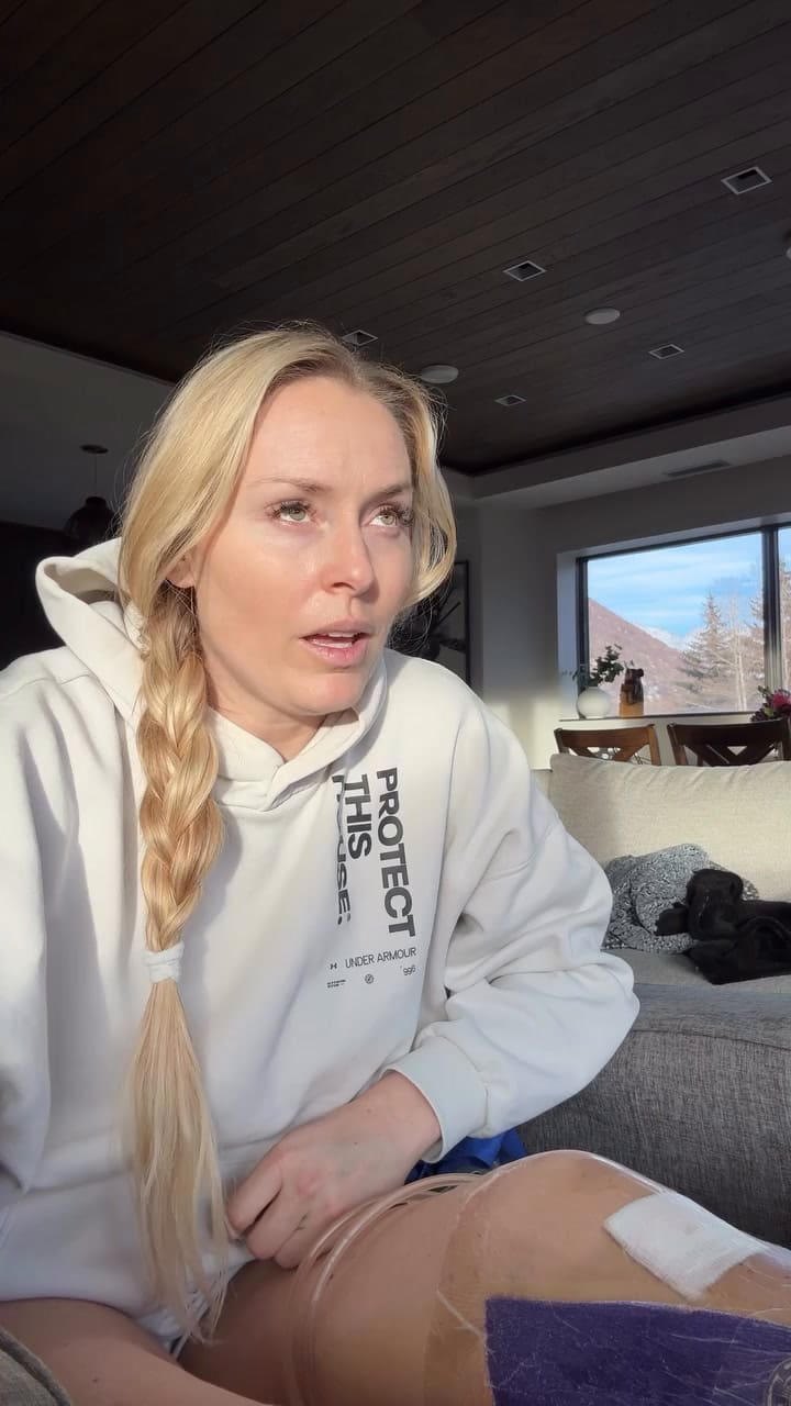 La esquiadora Lindsey Vonn contó que ya le dieron el alta médica y deberá estar un año sin practicar deporte