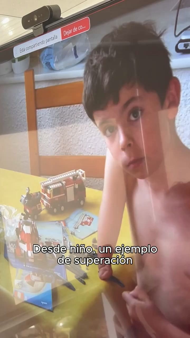 David Aguilar cuenta cómo creó su prótesis a base de piezas de LEGO
