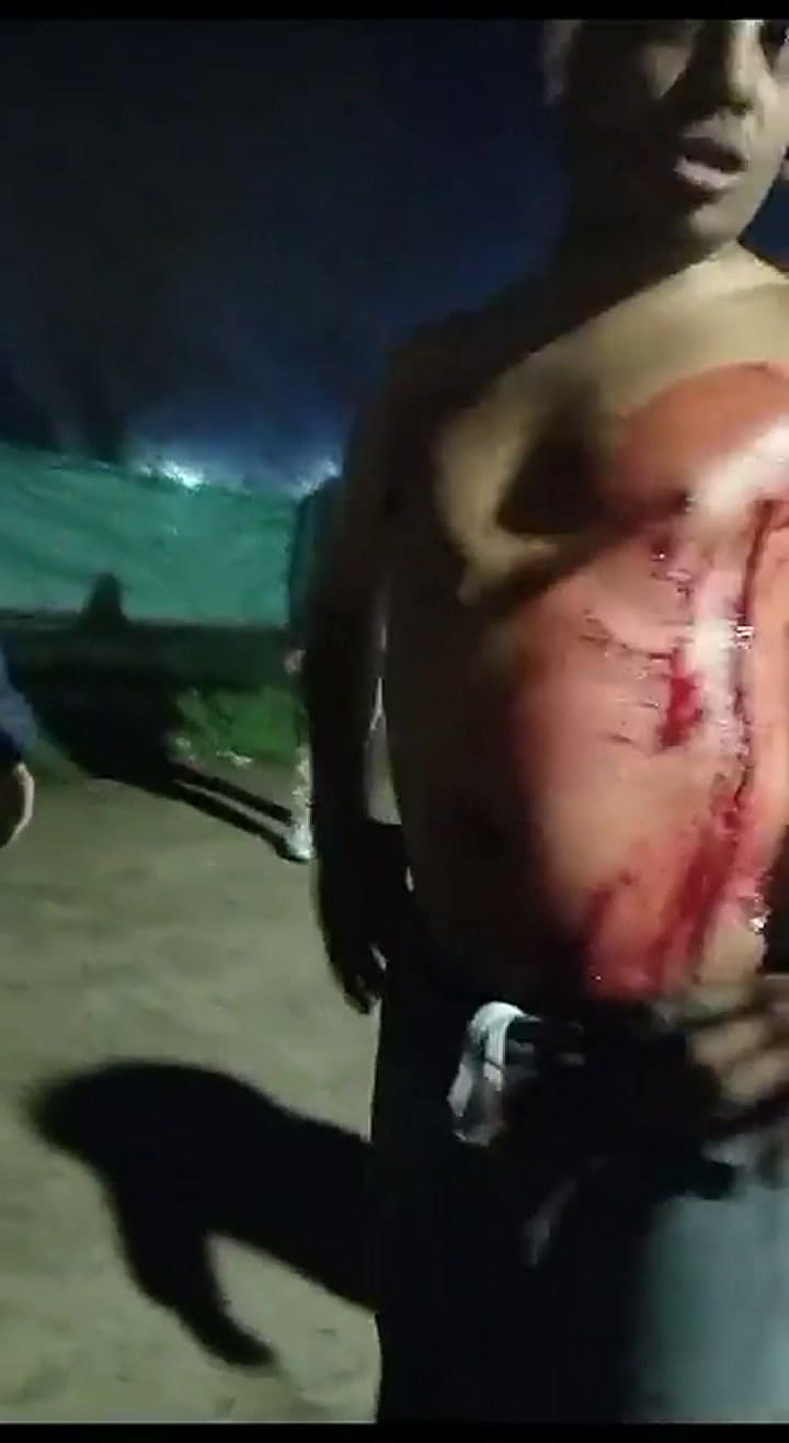 Un herido de bala durante un intento de saqueo en Rosario.