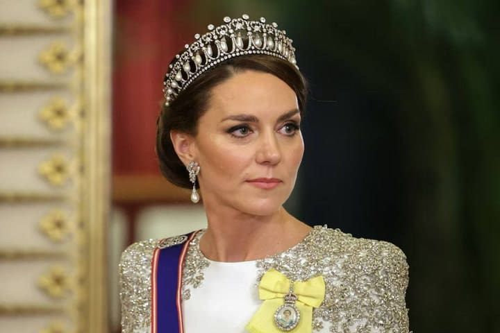 Princesa de Gales. Kate fue sometida a una cirugía abdominal y deberá hacer reposo al menos dos semanas