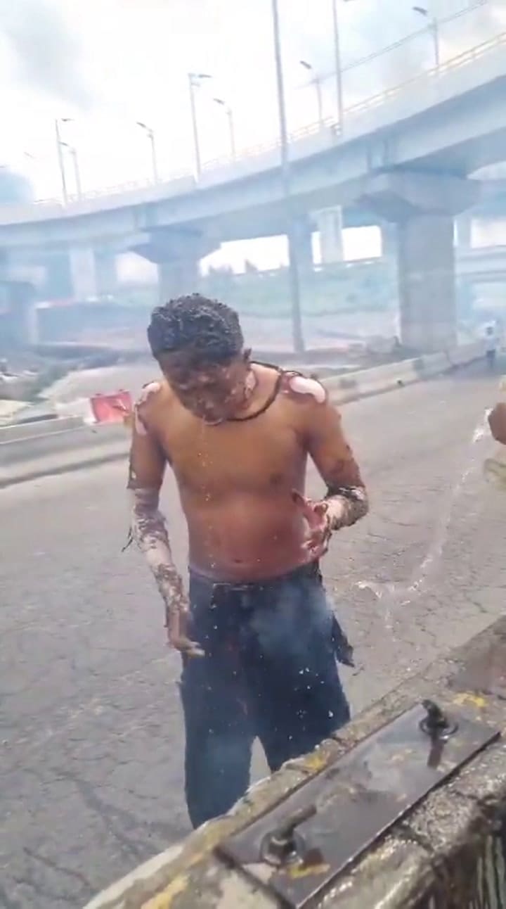 Una persona alcanzada por el fuego pide ayuda con visibles quemaduras en su cuerpo