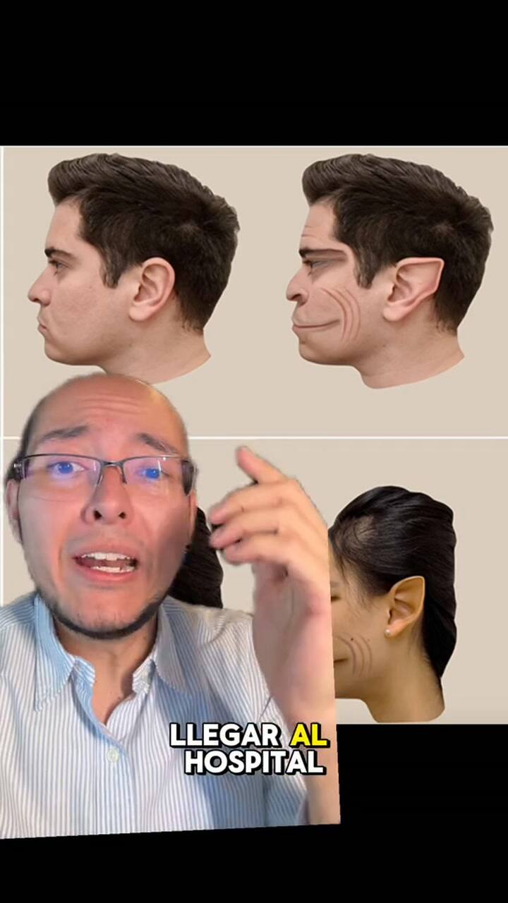¿Qué es la prosopometamorfopsia?