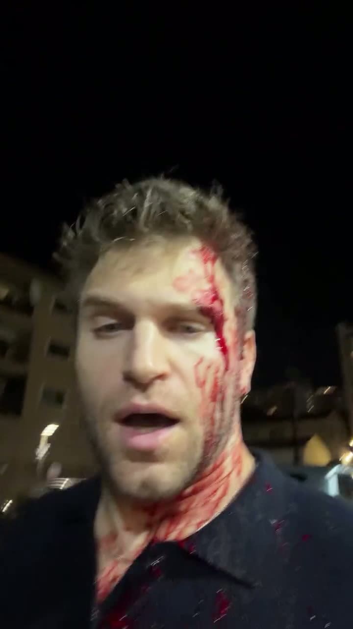 El actor Keegan Allen sufrió un violento asalto y terminó hospitalizado
