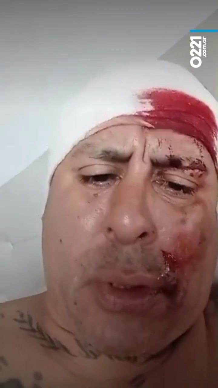 Escalada de violencia entre barrabravas de La Plata: uno de los heridos se filmó internado y prometió venganza