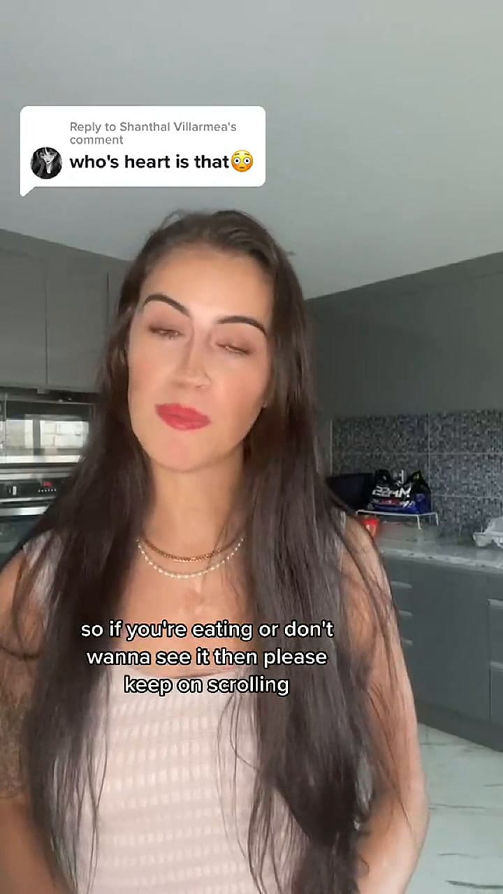 Jessica es una tiktoker que recibió un trasplante de corazón y exhibe su viejo órgano en redes