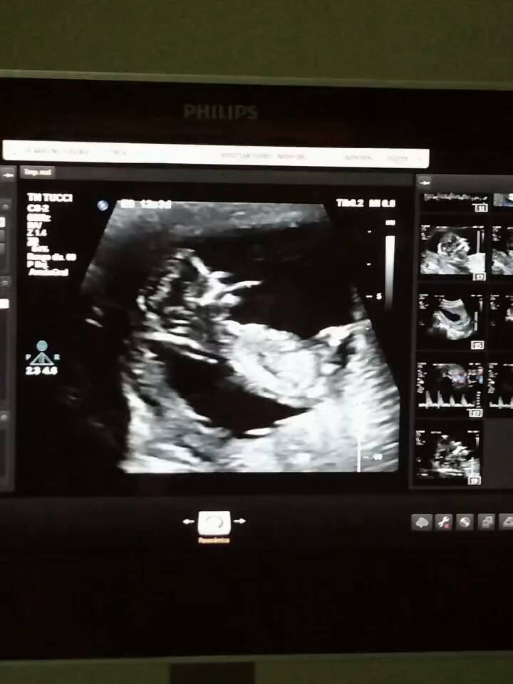 Diego Schwartzman y Eugenia De Martino esperan a su primera hija juntos (Video: Instagram @dieschwartzman)