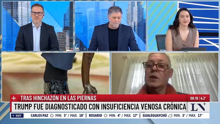 Jorge Farina, medico flebologo en LN+
