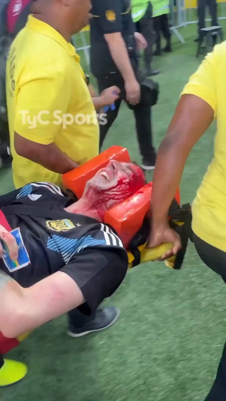 Imágenes Sensibles- Así Retiraron En Capilla A Un Hincha Argentino Agredido Por La Policía Brasileña