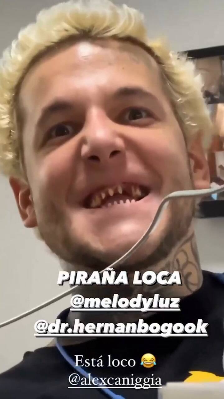 Asi son los dientes de Alex Caniggia (IG @melodyluz)