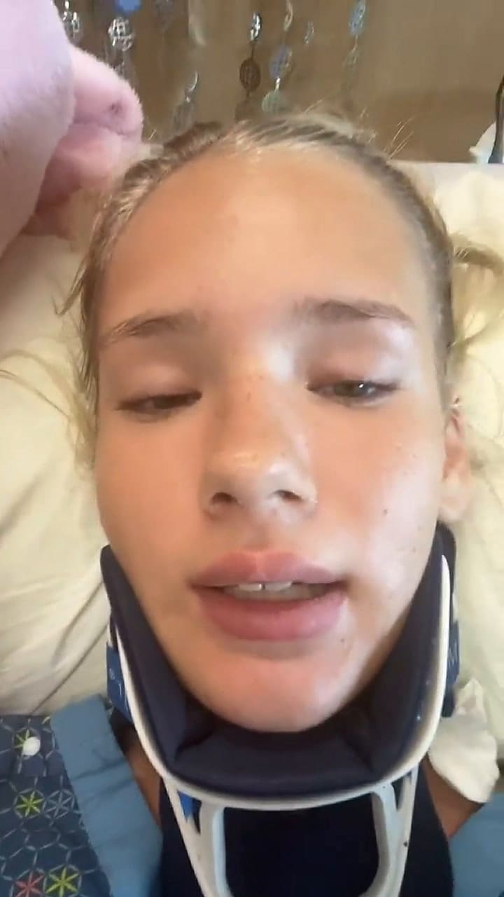 La usuaria de TikTok relató su terrible accidente