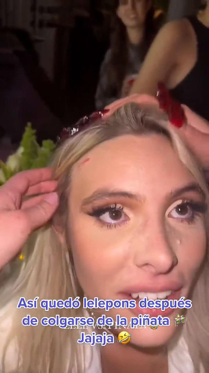Lele Pons terminó con heridas en las rodillas y en el rostro luego de su gran fiesta