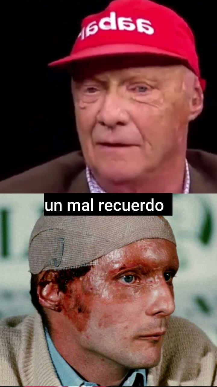 Niki Lauda Habla De Su Accidente