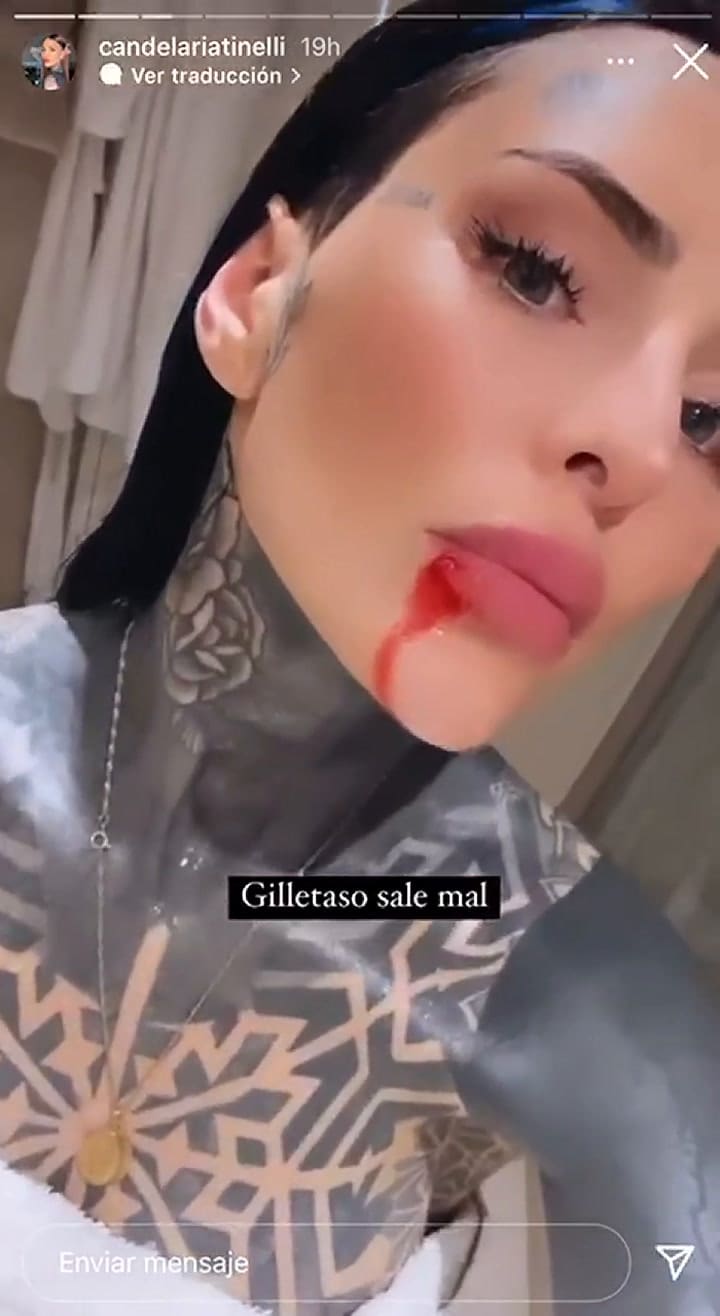 Candelaria Tinelli se cortó el labio con una gillette y lo compartió en las redes sociales