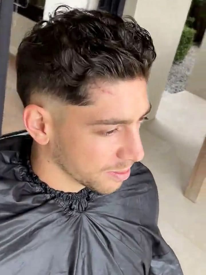 El video viral que muestra por primera vez la cicatriz de Fede Valverde tras su pelea con Tchouaméni en el vestuario de Real Madrid