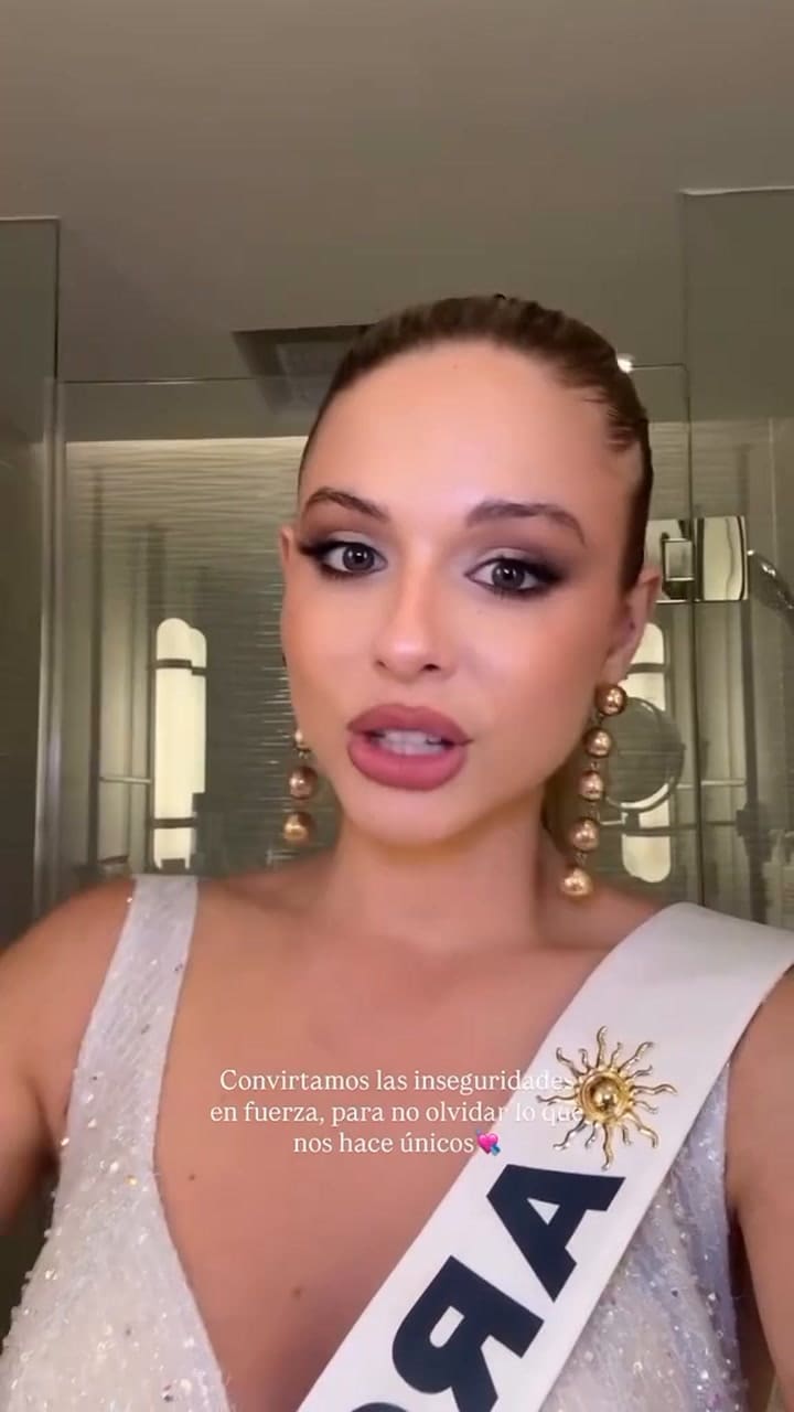 Aldana Mosset, candidata argentina a Miss Universo, confirmó que tiene alopecia
