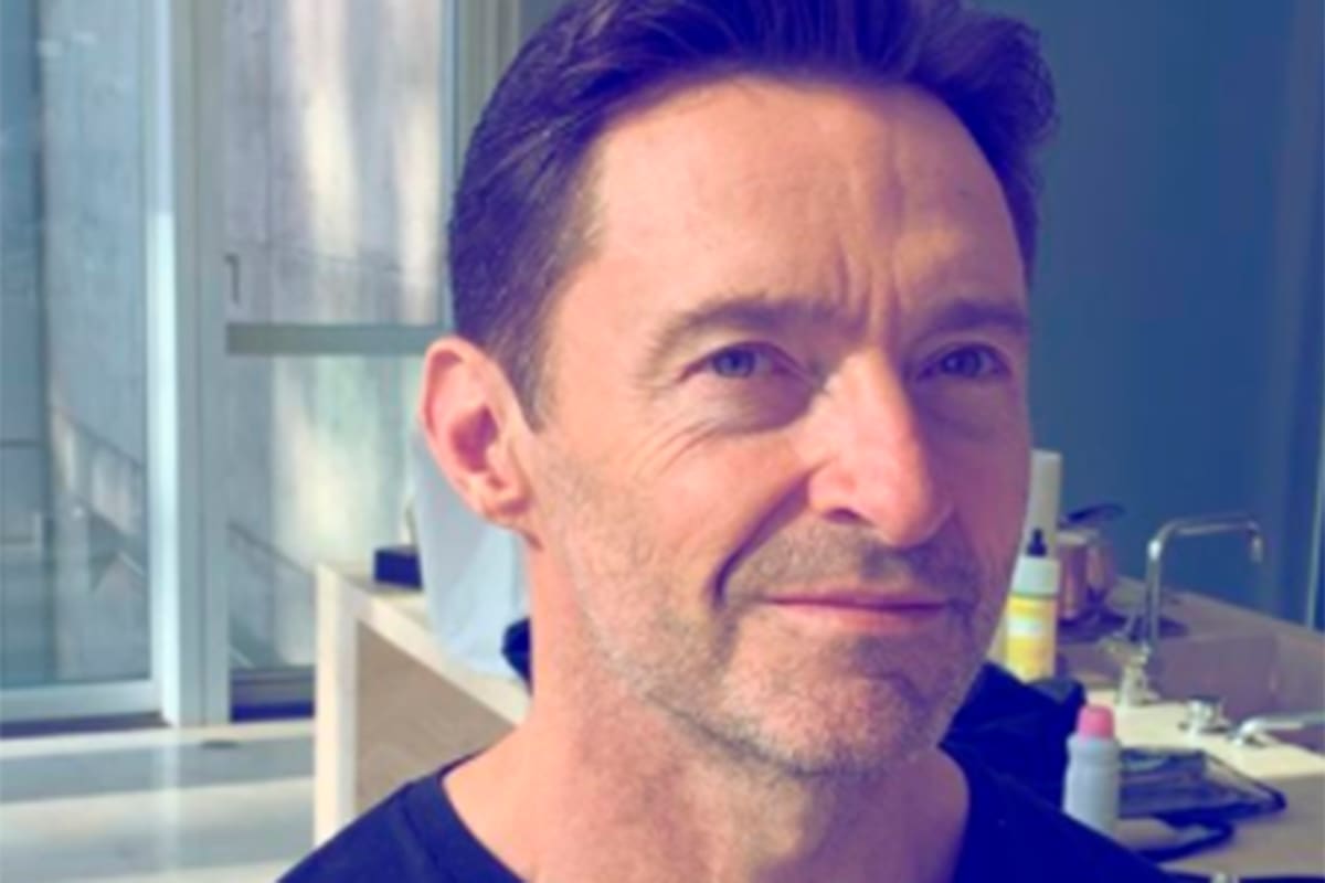 Hugh Jackman revela que los resultados de la biopsia de piel en su nariz “no son concluyentes”