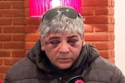 Hugo Aguilar el hombre atacado a la salida de un boliche en Necochea y que sufrió serias heridas producto de la paliza