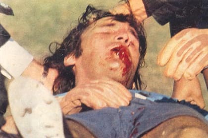 Hugo Gatti sufrió una triple fractura de mandíbula en 1976 y volvió a jugar en 28 días