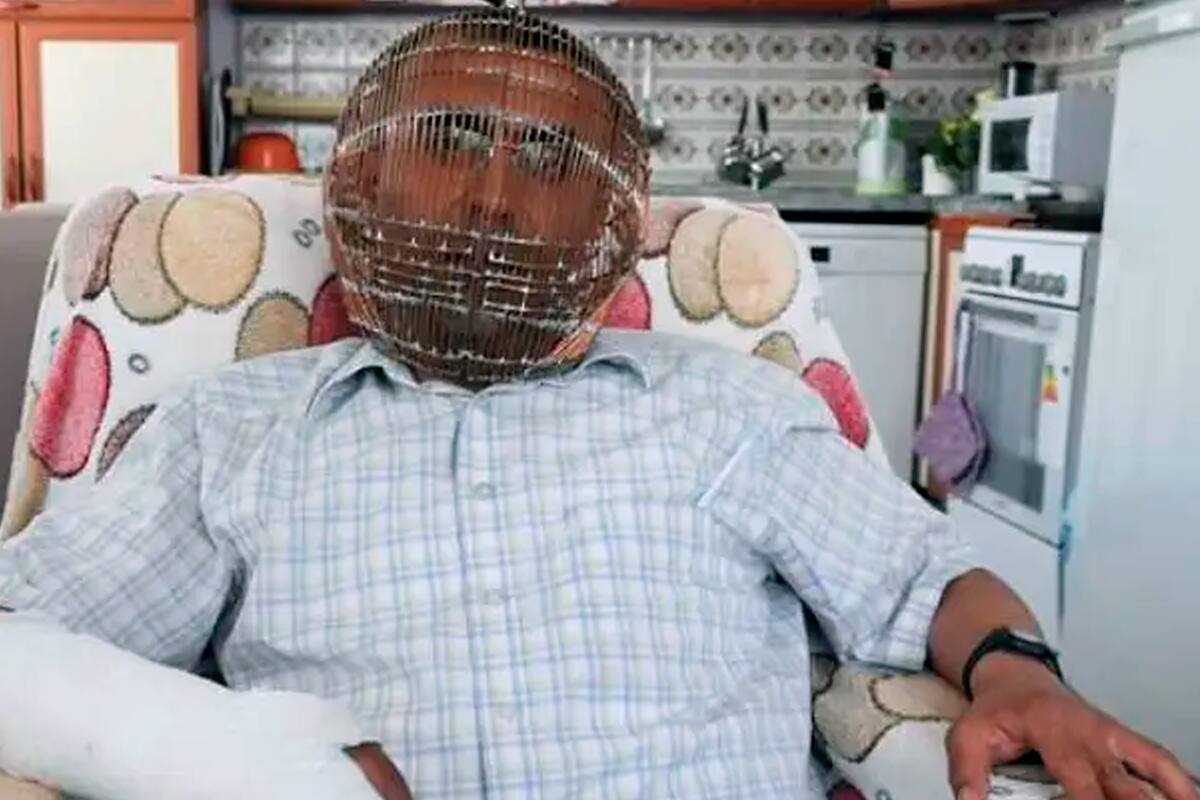 Ibrahim Yücel vive en una pequeña ciudad al oeste de Ankara tomó la drástica decisión después de varios años de no poder abandonar su adicción al cigarrillo