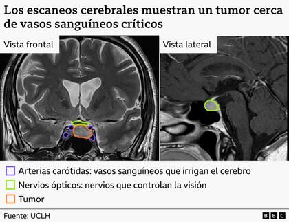 Identificar el lugar más seguro para extraerlo no fue sencillo