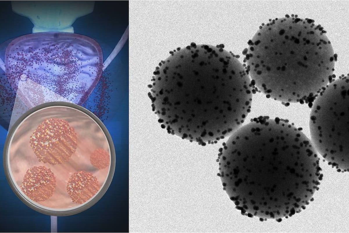 Ilustración de los nanorrobots en la vejiga del ratón (izq.) e imágenes reales de estas diminutas máquinas, que usan la urea como combustible