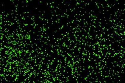 Imagen ampliada que muestra microbios revividos de sedimentos de 101,5 millones de años