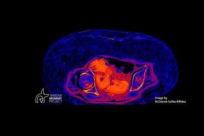 Imagen CT del feto preservado en una momia egipcia