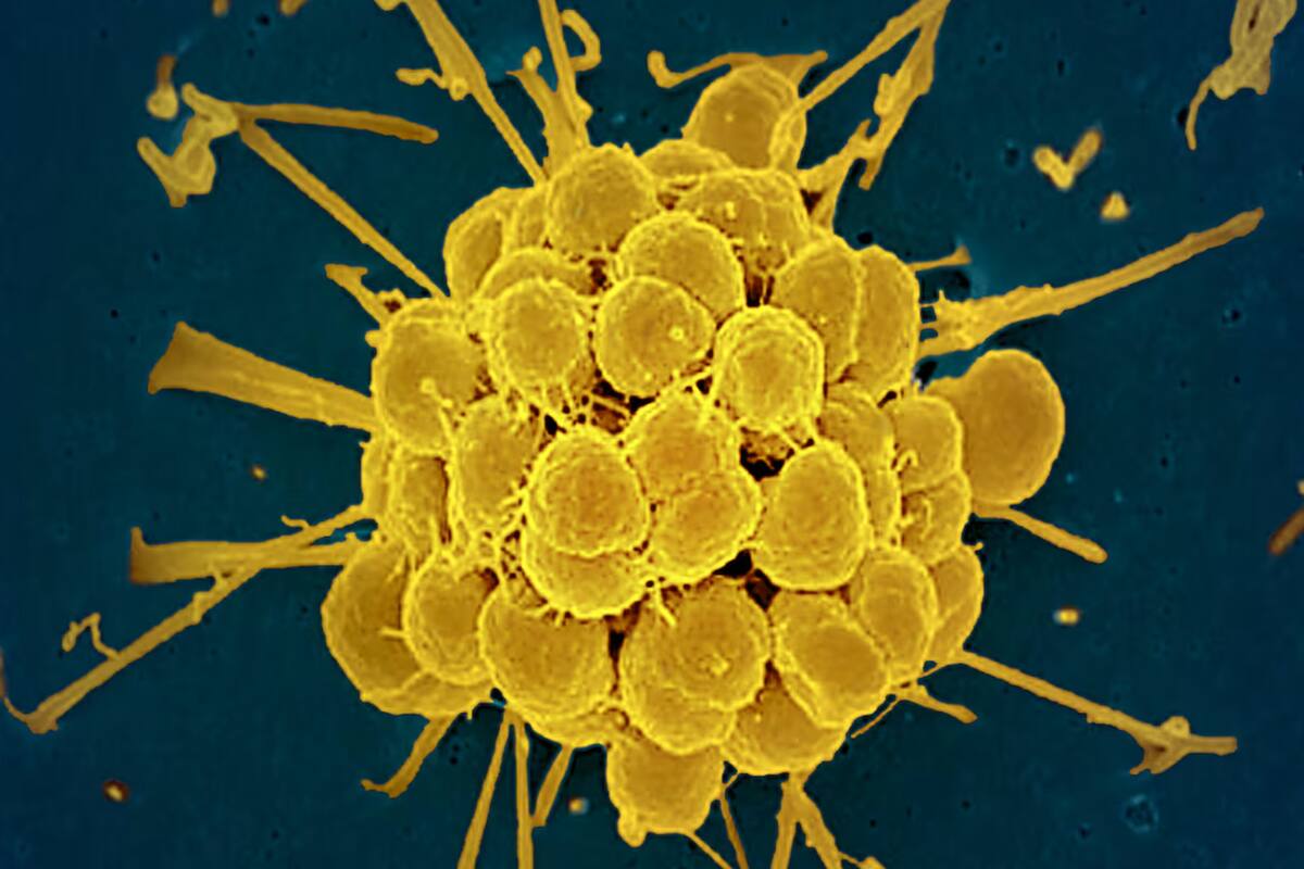 Imagen de las bacterias causantes de la gonorrea, obtenida con un microscopio electrónico