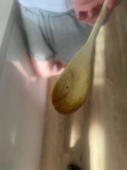 Imagen de los gusanos en la carne picada