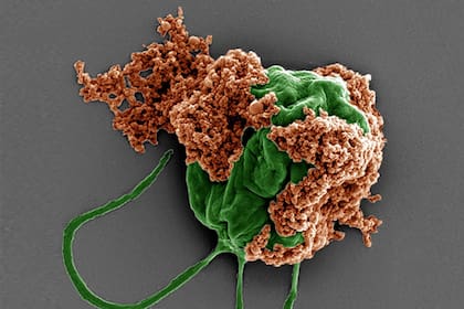 Imagen de microscopía de barrido electrónico de un microrobot formado por una célula de alga (verde) recubierta de nanopartículas rellenas de fármaco (naranja) recubiertas de membranas de glóbulos rojos