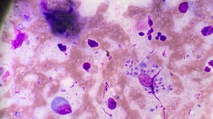 Imagen de microscopía de parásitos de Leishmania en frotis de lesión cutánea (Foto: CONICET)