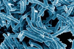 Imagen de microscopio de la bacteria "Mycobacterium tuberculosis"