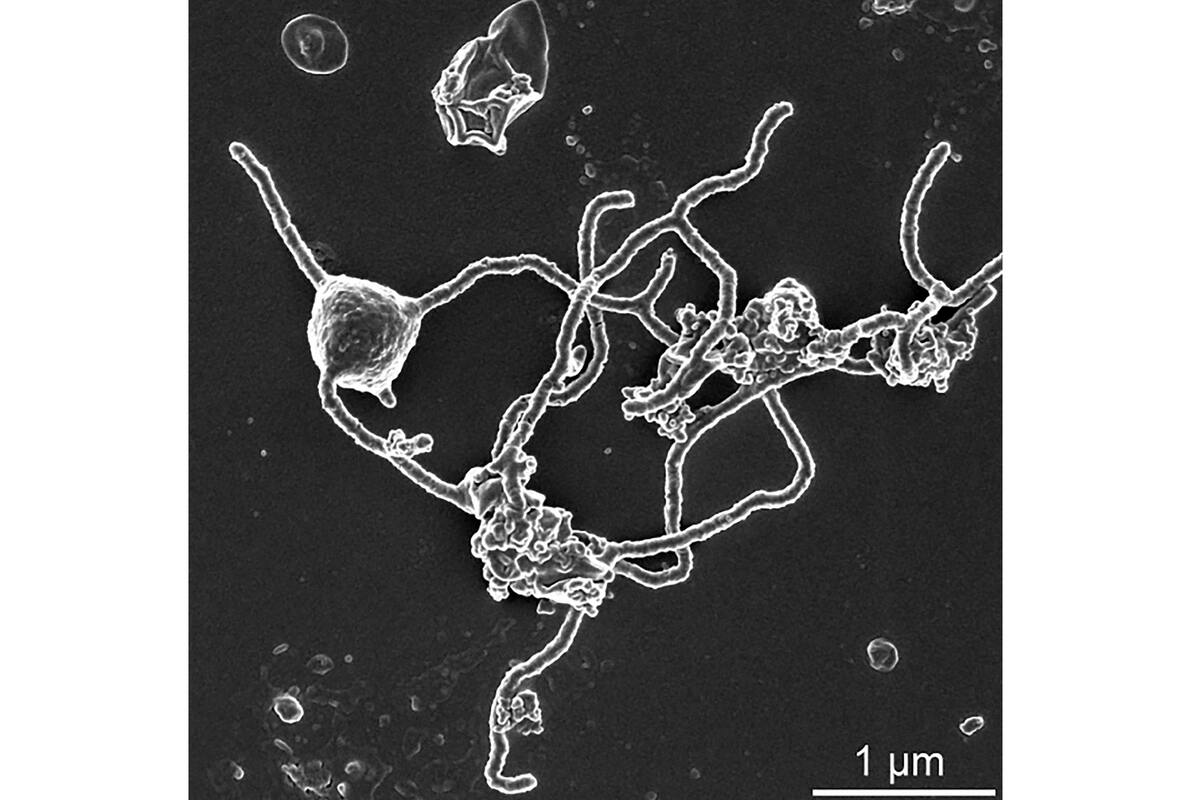 Imagen de microscopio electrónico de barrido de Prometheoarchaeum syntrophicum, un microbio que los científicos encontraron en el fondo del océano y está estrechamente relacionado con una vida más compleja
