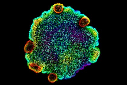 Imagen de un placozoo, obtenida con un microscopio confocal