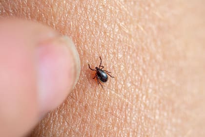 Imagen de una garrapata marrón en la piel humana con un dedo a punto de retirarla