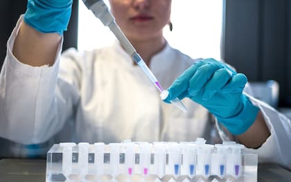 (Imagen ilustrativa). Una investigación determinó un punto clave en el sistema inmune