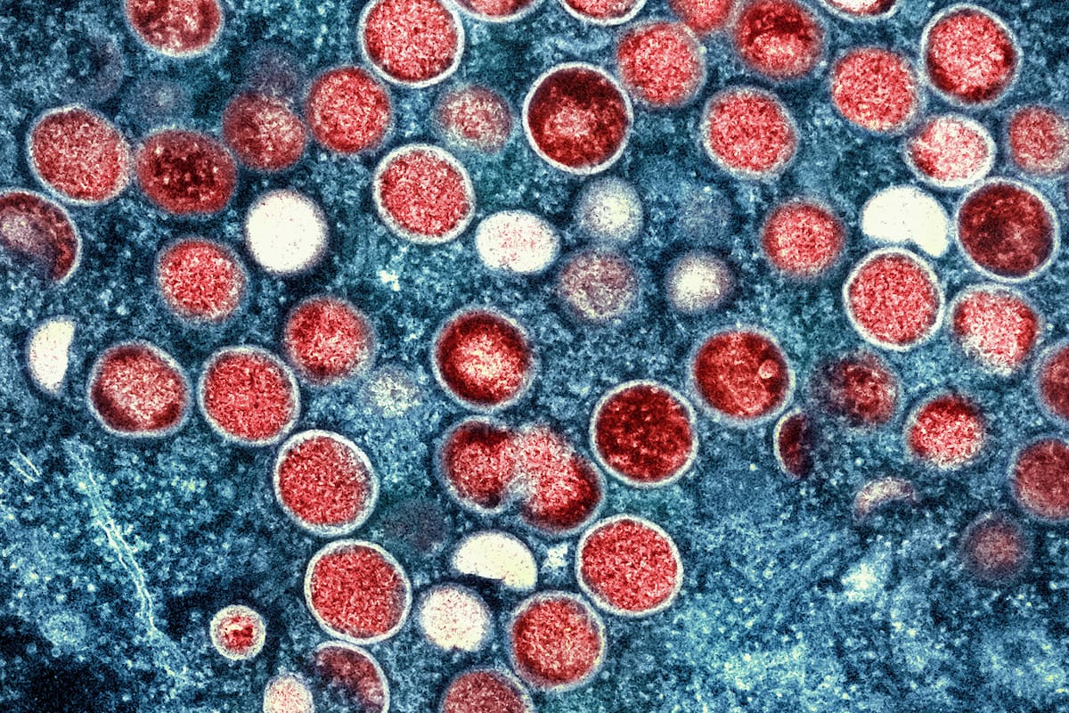 Imagen proporcionada por el Instituto Nacional de Enfermedades Alérgicas e Infecciosas de Estados Unidos (NIAID, por sus siglas en inglés), muestra una micrografía electrónica de transmisión coloreada de partículas de viruela símica (rojo) que se encuentran dentro de una célula infectada (azul), cultivada en el laboratorio (NIAID vía AP, Archivo).