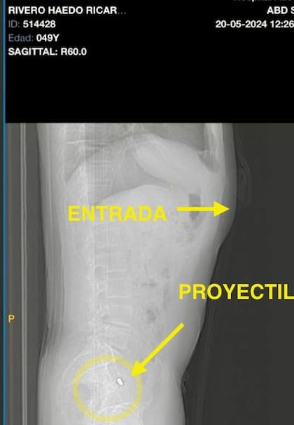 Imagen que muestra el impacto de bala