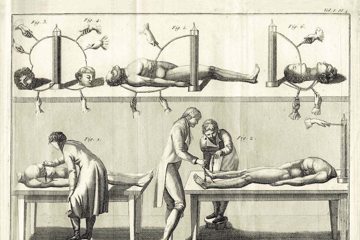 Imagen que pertenece a los experimentos con electricidad sobre seres humanos de Giovanni Aldini, circa 1800