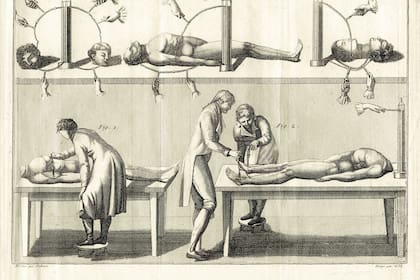 Imagen que pertenece a los experimentos con electricidad sobre seres humanos de Giovanni Aldini, circa 1800