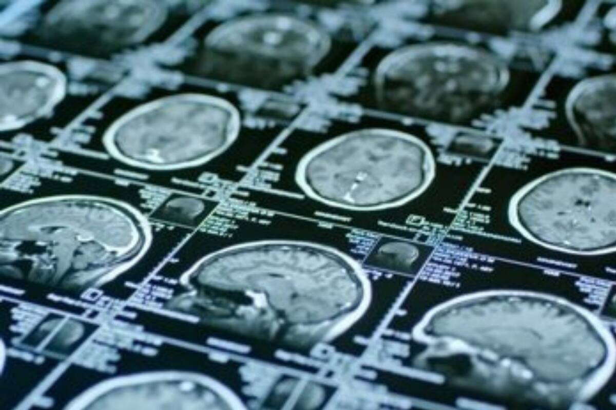 Imágenes de resonancia magnética de un cerebro
