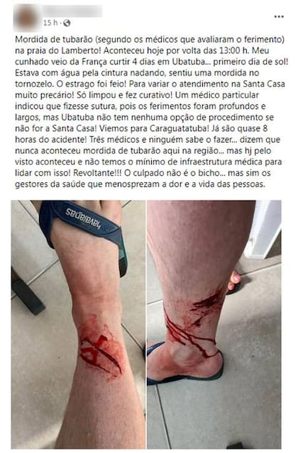 Imágenes difundidas por la familia del turista francés, quien se encuentra a salvo y de regreso en su país