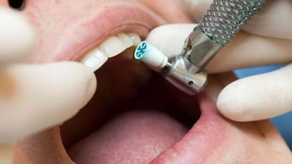 ¿Cómo está tu lengua? Lo que dicen expertos de Harvard sobre las señales de alerta
