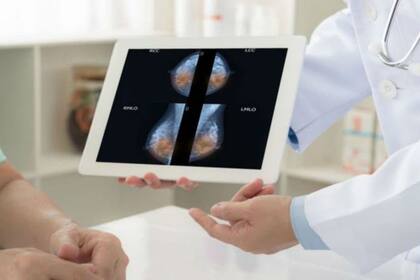 Importante avance contra el cáncer de mama