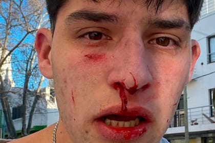 Incidentes en Junín