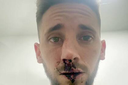 Incidentes en el partido entre Estudiantes (BA) y Chacarita, donde resultó agredido el jugador Nicolás Morgantini que estaba en la tribuna mirando el encuentro