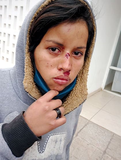 “Indios infectados, hay que matarlos a todos”, exclamaban los policías que irrumpieron a los tiros el 31 de mayo en el barrio qom Bandera Argentina, uno de los seis del llamado Gran Toba, en Resistencia, Chaco. Al día siguiente se viralizó un video donde se veía a los efectivos golpeando a hombres y