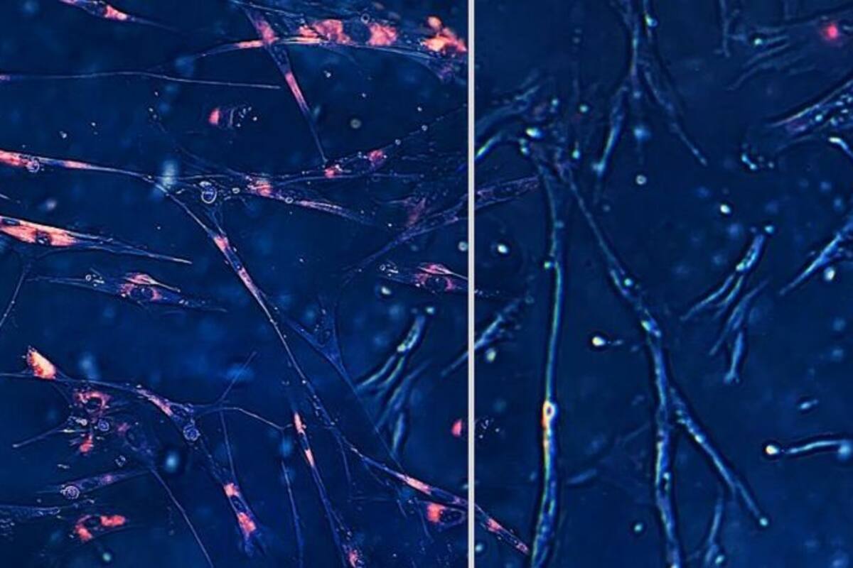 inteligencia artificial