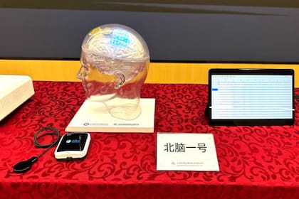 Interfaz cerebro-máquina semiinvasiva en una conferencia de prensa organizada por el Instituto Chino de Investigación Cerebral de Pekín (CIBR) y NeuCyber NeuroTech (Beijing) Co., Ltd. en Pekín, capital de China, el 20 de marzo de 2025
