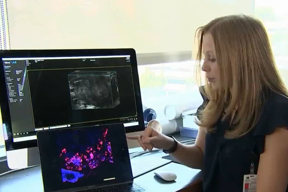 Investigadores de Massachusetts han descubierto que el uso de nanopartículas para administrar medicamentos puede reducir el tamaño de los tumores en ratones (captura de video)